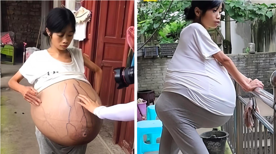 1 Mother’s Big Belly Makes Everyone Think She Is Pregnant