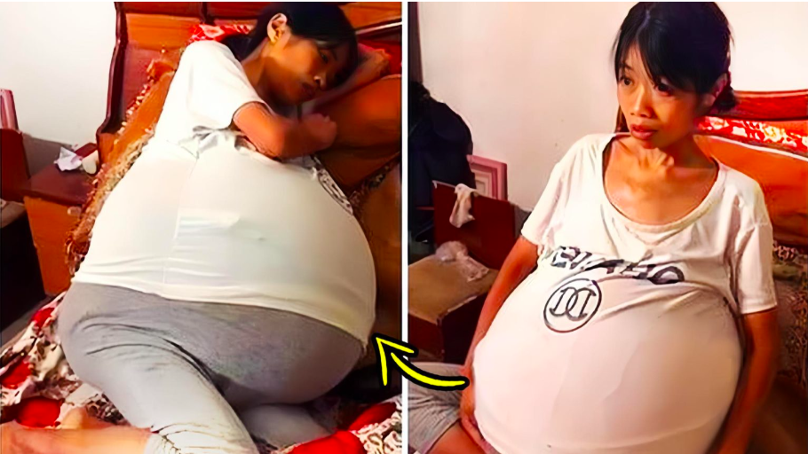 2 Mother’s Big Belly Makes Everyone Think She Is Pregnant