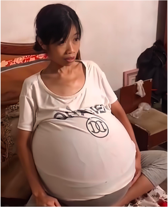 3 Mother’s Big Belly Makes Everyone Think She Is Pregnant